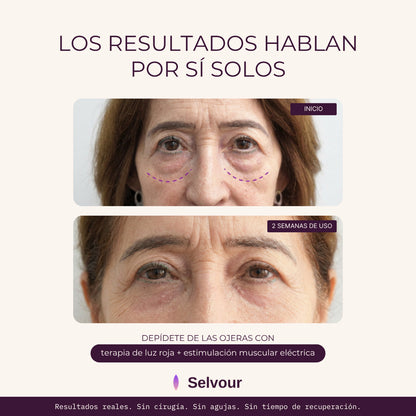 ORAYA™ | Elimina las ojeras con luz roja