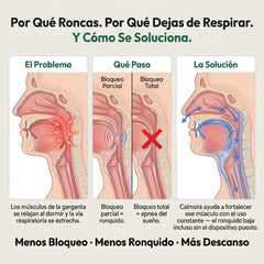 Diagrama de por que se ronca y como actua Calmora
