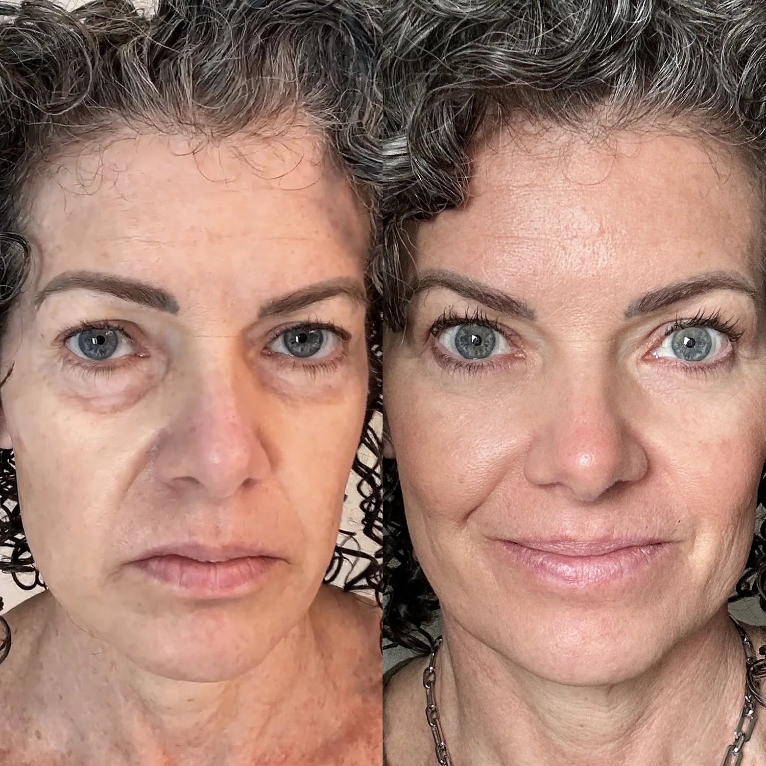 Antes y despues