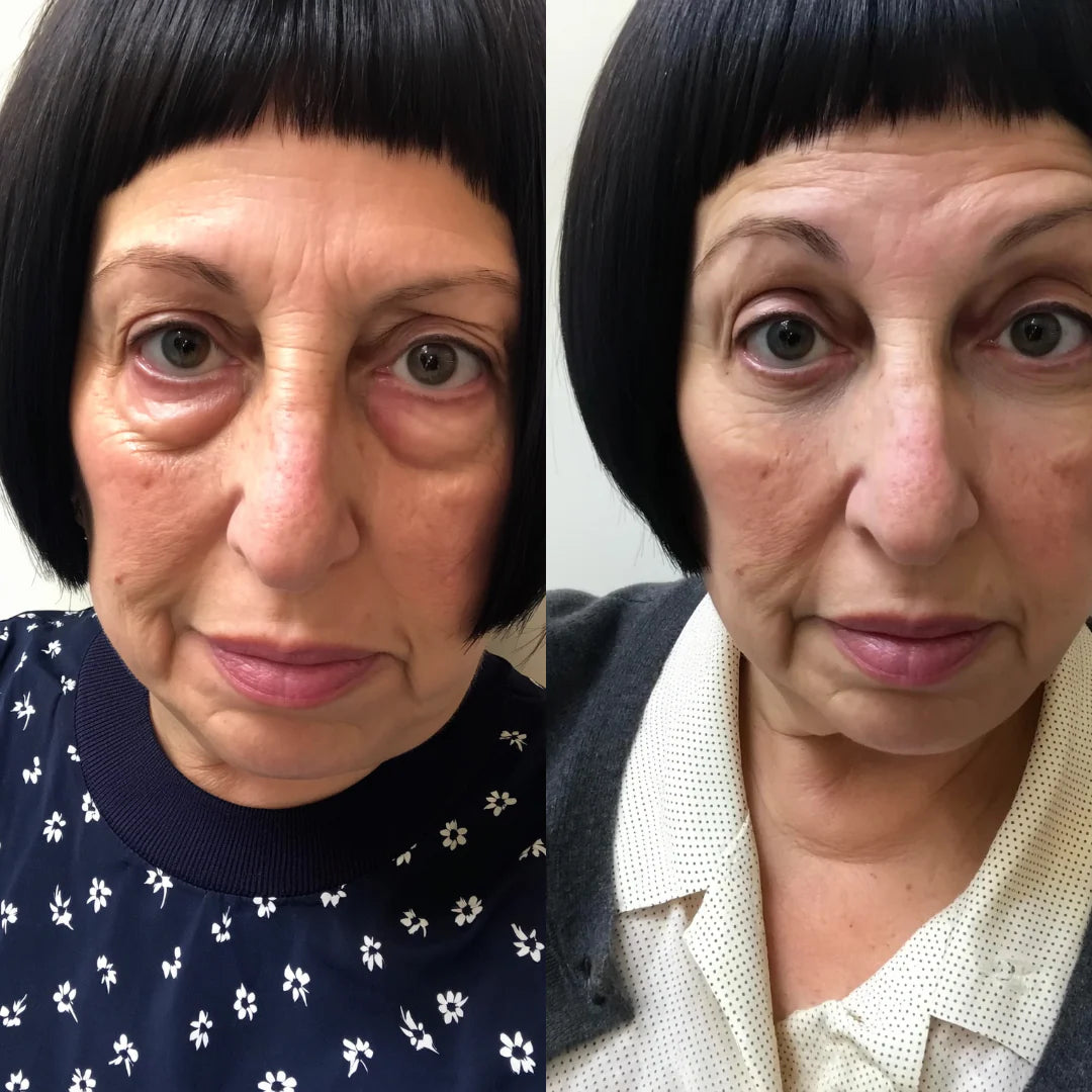 Antes y despues real